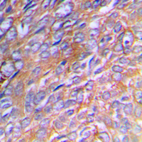 19 - Anti-Collagen 3 alpha 1 Antibody AP51104