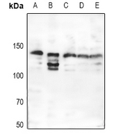 1 - Anti-Collagen 3 alpha 1 Antibody AP51104