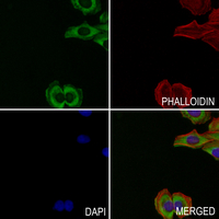 3 - Anti-Collagen 3 alpha 1 Antibody AP51105