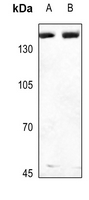 1 - Anti-Collagen 3 alpha 1 Antibody AP51105