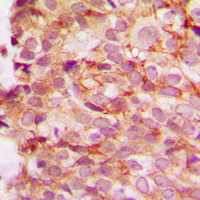 19 - Anti-Collagen 4 alpha 1 Antibody AP51106