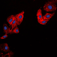 3 - Anti-Collagen 5 alpha 1 Antibody AP51107