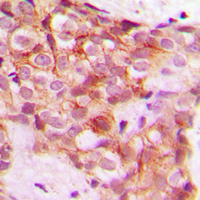 19 - Anti-Collagen 5 alpha 1 Antibody AP51107