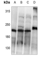 1 - Anti-Collagen 5 alpha 1 Antibody AP51107