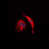 3 - Anti-Collagen 5 alpha 3 Antibody AP51108
