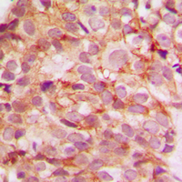 19 - Anti-Collagen 5 alpha 3 Antibody AP51108
