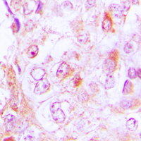 19 - Anti-Collagen 6 alpha 2 Antibody AP51109