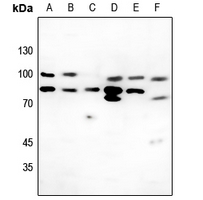 1 - Anti-Collagen 6 alpha 2 Antibody AP51109
