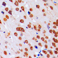 19 - Anti-JAB1 Antibody AP51110