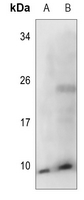 1 - Anti-COX17 Antibody AP51111