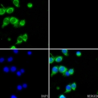 3 - Anti-Carboxypeptidase A1 Antibody AP51112