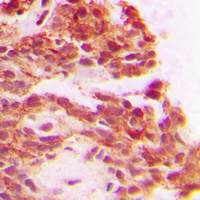 19 - Anti-Carboxypeptidase A1 Antibody AP51112