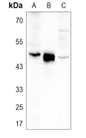 1 - Anti-Carboxypeptidase A1 Antibody AP51112