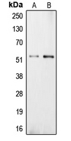 1 - Anti-Carboxypeptidase E Antibody AP51113