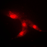 3 - Anti-CRABP2 Antibody AP51114