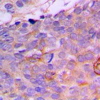 19 - Anti-CRABP2 Antibody AP51114