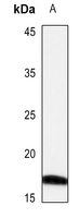 1 - Anti-CRABP2 Antibody AP51114