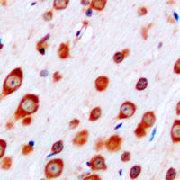 19 - Anti-CRHR2 Antibody AP51116
