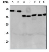 1 - Anti-CRHR2 Antibody AP51116