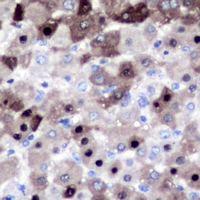 19 - Anti-XPO2 Antibody [KO/KD Validated] AP51117
