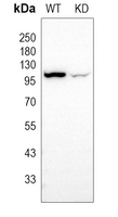 0 - Anti-XPO2 Antibody [KO/KD Validated] AP51117