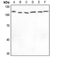 1 - Anti-XPO2 Antibody [KO/KD Validated] AP51117