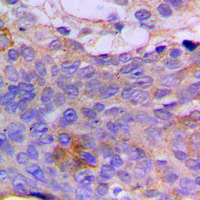19 - Anti-CSGALNACT1 Antibody AP51118