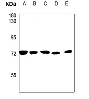 1 - Anti-CSGALNACT1 Antibody AP51118
