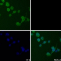 3 - Anti-CK2 beta Antibody [KO/KD Validated] AP51119