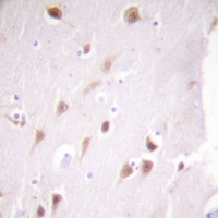 19 - Anti-CK2 beta Antibody [KO/KD Validated] AP51119