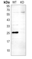 0 - Anti-CK2 beta Antibody [KO/KD Validated] AP51119