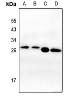 1 - Anti-CK2 beta Antibody [KO/KD Validated] AP51119