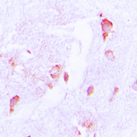 19 - Anti-CSRNP2 Antibody AP51120