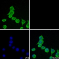 3 - Anti-CSRP1 Antibody AP51121