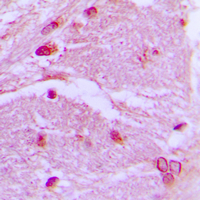 19 - Anti-CSRP1 Antibody AP51121