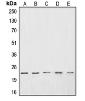 1 - Anti-CSRP1 Antibody AP51121