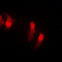 3 - Anti-Cystatin B Antibody AP51123