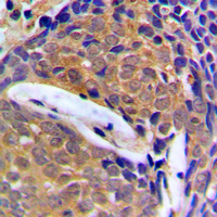 19 - Anti-Cystatin B Antibody AP51123