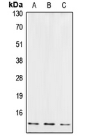 1 - Anti-Cystatin B Antibody AP51123