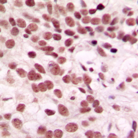 19 - Anti-CTDSP1 Antibody AP51124