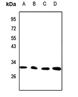 1 - Anti-CTDSP1 Antibody AP51124