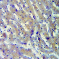 19 - Anti-Cathepsin A 32k Antibody AP51127