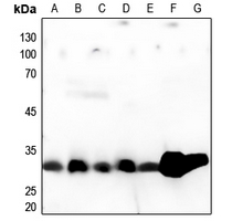 1 - Anti-Cathepsin A 32k Antibody AP51127