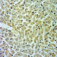 19 - Anti-Cathepsin D LC Antibody [KO/KD Validated] AP51128