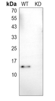 0 - Anti-Cathepsin D LC Antibody [KO/KD Validated] AP51128