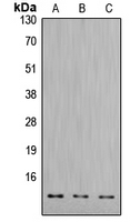 1 - Anti-Cathepsin D LC Antibody [KO/KD Validated] AP51128