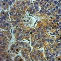 19 - Anti-Cathepsin D HC Antibody AP51129