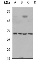 1 - Anti-Cathepsin D HC Antibody AP51129