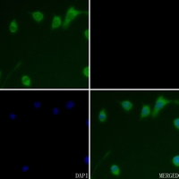 3 - Anti-Cathepsin D Antibody AP51130