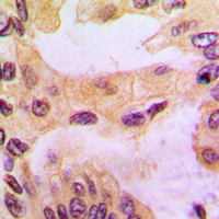 19 - Anti-Cathepsin D Antibody AP51130